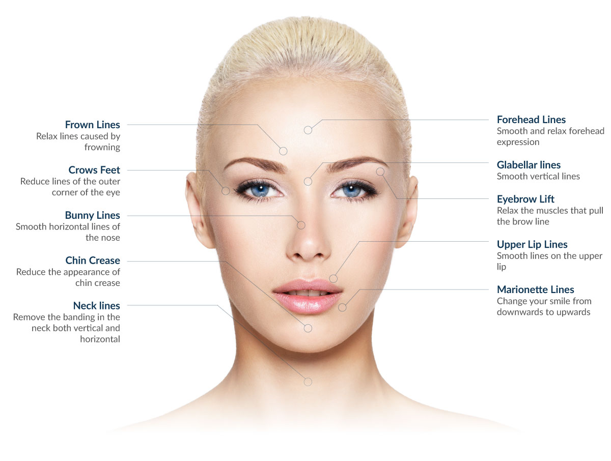Botox Treatment Areas