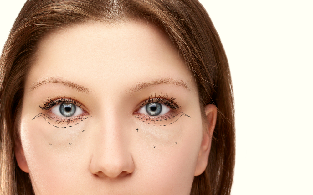Non-Surgical Eye Lifts in Chicago | Under Eye Bags Removal & Treatment