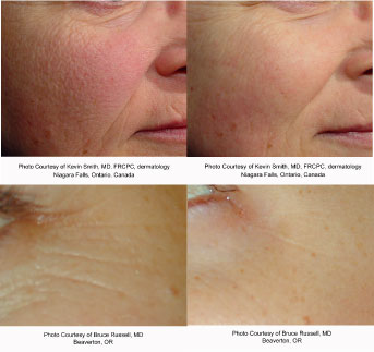Skin Care Results 1