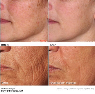 Skin Care Results 2