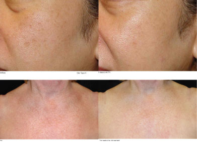 Skin Care Results 3