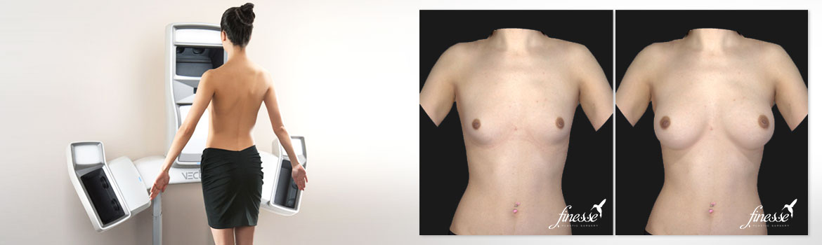 Vectra 3D Breast Imaging