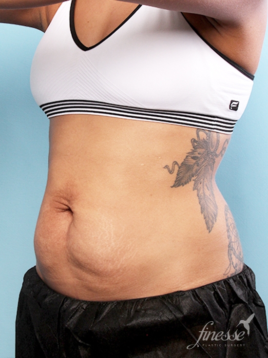 DL Plastic Surgery International (@dl_plastic_int