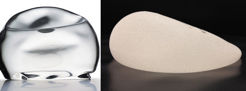 What happens when breast implants leak?