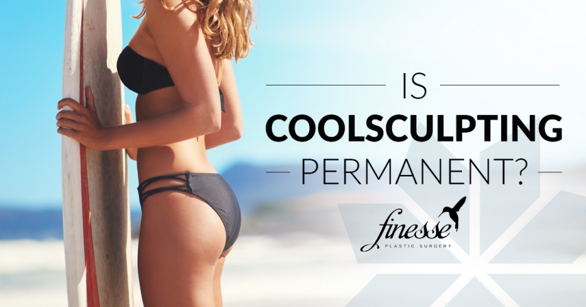 Is CoolSculpting Permanent?