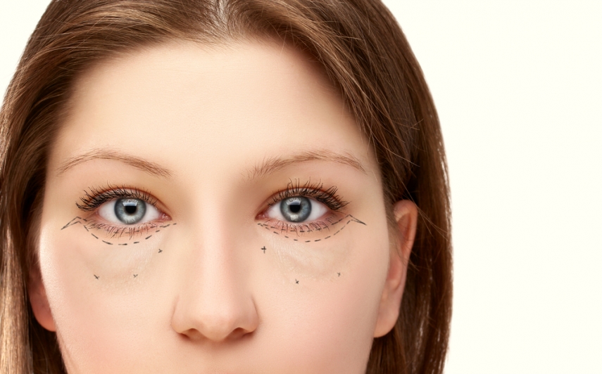 Puffy Eyes Dark Circles and Bags Dermatologists Explain the Difference   SELF